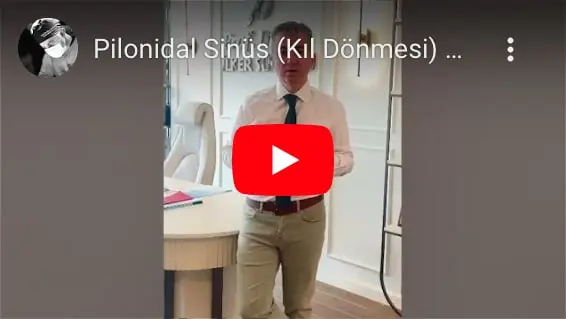 Pilonidal Sinüs (Kıl Dönmesi) 5 Dakikada Tedavisi Mümkün Mü?